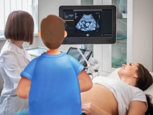 A picture of an obstetrician scanning a pregnant woman with a System C Healthcare worker.